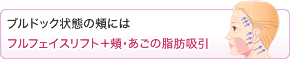 ブルドック状態の頬にはフルフェイスリフト+頬・顎の脂肪吸引
